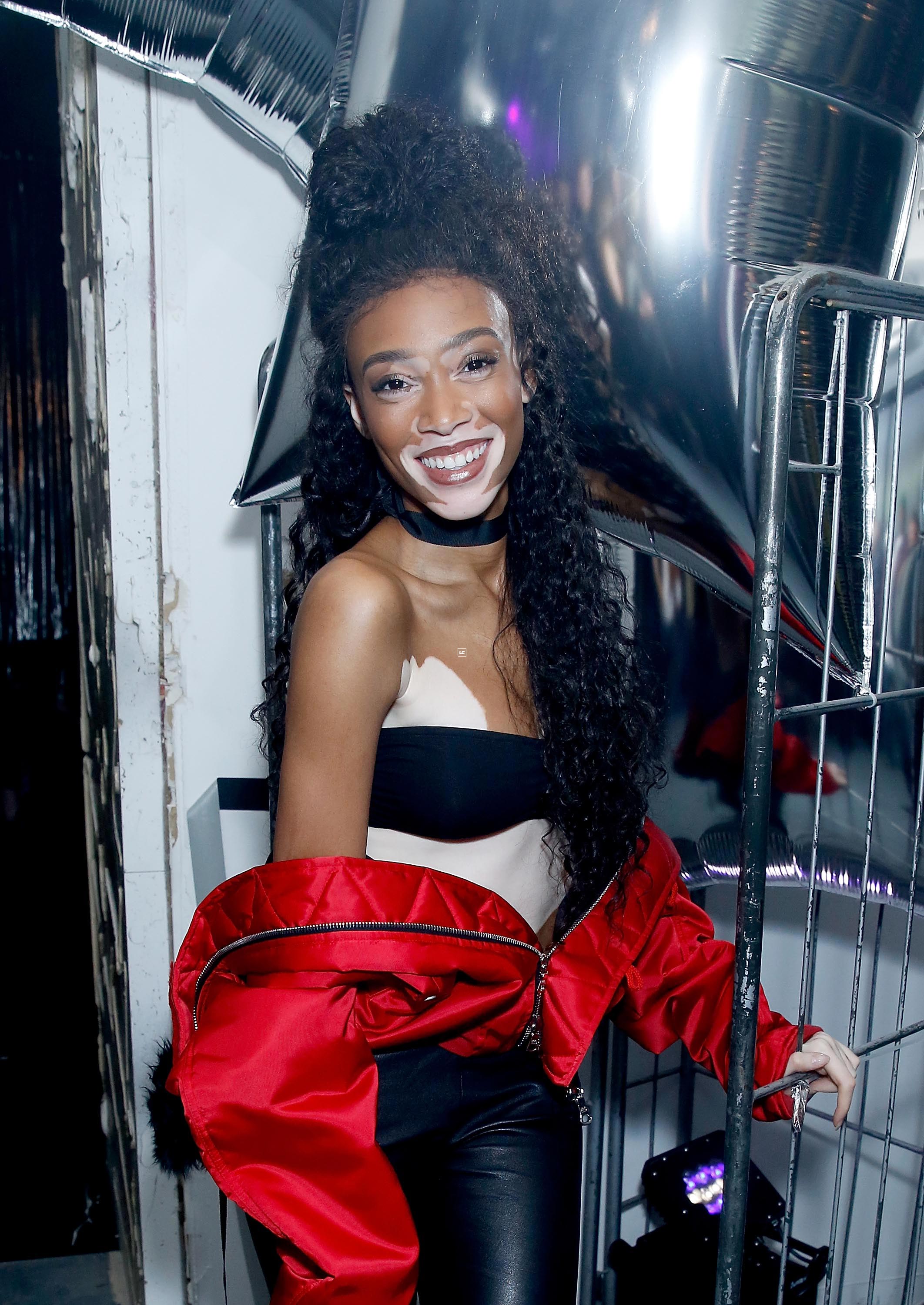 Winnie Harlow attends Dazed magazine’s 25th birthday party